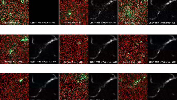 麻省理工学院的显微镜技术改善了深层组织成像质量